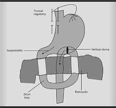 Image result for Succussion Splash