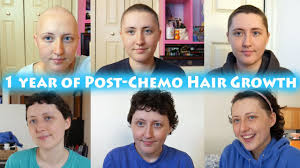 They are the most popular types of hair dyes, because the color changes last until the hair is replaced by new growth. Hair Growth After Chemo One Year My Cancer Story Youtube