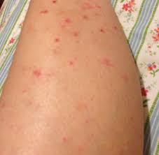The easiest way to do this is through proper hair and skin hygiene. Pin On Diy Beauty