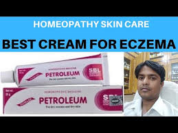 A complete list of discoid eczema medicines in the india with instructions, dosage, and route of administration. Top 10 Things To Heal From Eczema And Tsw My Journey Of Healing Youtube