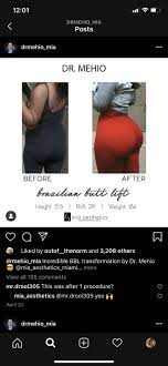 Mia aesthetics 6929 airport blvd ste 103. Pin By Nicole M On Dr Mehio Bbl Vision Board 10 6 20 Pear Body Shape Butt Lift The Incredibles