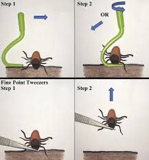 Image result for Tick Removal