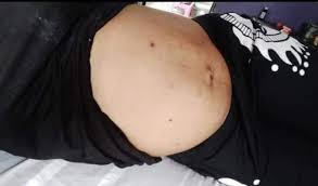 .known as ada jesus on her facebook page (ada jesus comedy) dated 22 december 2019. Comedian Ada Jesus Diagnosed With Kidney Problem Photos
