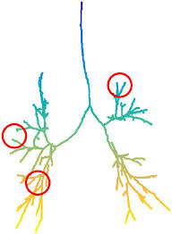Bài tập cải thiện xuất tinh sớm. Lung Topology Characteristics In Patients With Chronic Obstructive Pulmonary Disease Scientific Reports