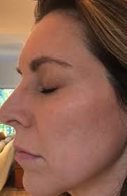 Skin Clique: Aesthetics, Skincare, Hair Loss & GLP-1