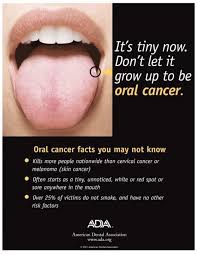 Laura makaroff talk about the importance screeningexternal icon means checking your body for cancer before you have symptoms. Huntingdon Dental Care Llc April Is Oral Cancer Awareness Month We Perform An Oral Cancer Screening With Every Cleaning Contact Us If You Have Any Questions Facebook