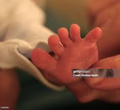 Image result for Babinski Reflex