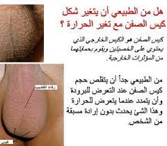 fay3 هل من الطبيعي أن يتغير شكل كيس الصفن مع تغير الحرارة