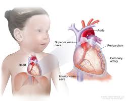 Learn about the common signs and symptoms of lung cancer such as a worsening cough, loss of appetite, or shortness of breath. Childhood Cardiac Heart Tumors Treatment Pdq Patient Version National Cancer Institute