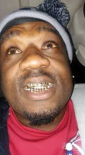 Gold Grills by flocca