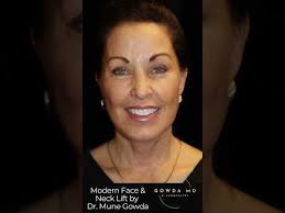 Facelift Surgery Novi & Troy