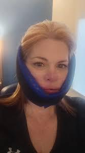 Dental Implant Experience in Costa Rica with Dr Urzola Dentistry