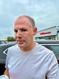 Plastic Surg€ry is successful. Thank you God! And thank you all for the  support, encouragement and prayers! Now healing begins. Btw, the cancer  spot was a size of a penny and also