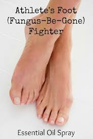 Let Life Blossom Athlete S Foot Fungus Be Gone Fighter Essential Oil Spray Athletes Foot Essential Oils Essential Oils