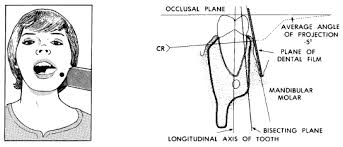 Dental Radiography