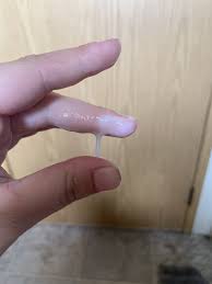 This discharge is known as leukorrhea, and it's completely normal. Tmi Photo Thick White Stretchy Discharge Trying To Conceive Forums What To Expect