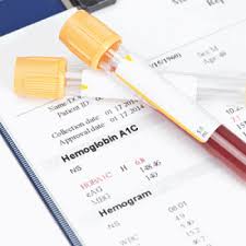 The Role Of Hemoglobin A1c In The Assessment Of Diabetes And