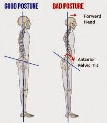 10 Graphs That Help You Improve Posture In No Time Exercise Pelvic Tilt Bad Posture