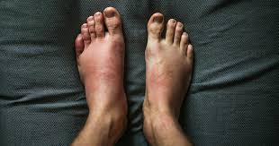 Leg Rash Symptoms Causes Treatments