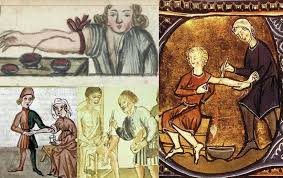 Medieval Bloodletting and the Four Humors – The Medieverse: Tim's Realistic  "medieval" FANTASY Blog