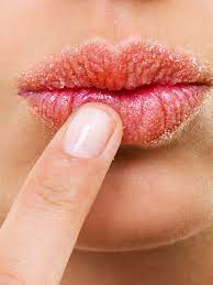 Dry Lips: The Causes, Treatments And Products To Try Now | Glamour Uk