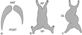 Maybe you would like to learn more about one of these? Basics Of Cardiac Development For The Understanding Of Congenital Heart Malformations Pediatric Research