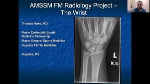 Image result for Wrist XRay