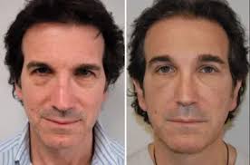 King Soopers planned for Erie's Nine Mile Corner