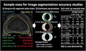 Designing Image Segmentation Studies Statistical Power Sample Size And Reference Standard Quality Sciencedirect