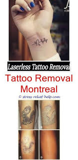 Private tattoo removal clinics specialize solely in laser tattoo removal. Tattoo Removal Prices Pico Laser Tattoo Removal Cost What Options Are Available For Tattoo Removal Tattoo Removal Cost Eyebrow Tattoo Removal Tattoo Removal