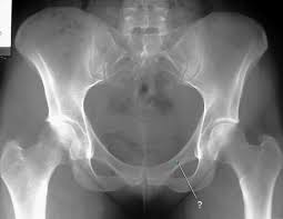 Although ultrasound images are another modality typically used for imaging the pelvic region, excluding ultrasound from the tutorial was a pedagogical decision, as the tutorial targets novice learners. Knowledge Assessment