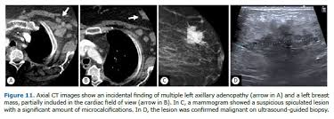 Image result for Incidental Imaging Finding