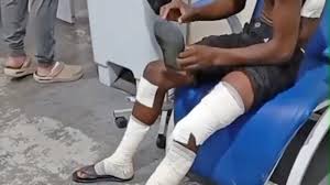 Bomba caseira explode em escola de Belford Roxo e fere 10 alunos