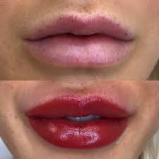 Alexwikoff Before And After Lips By Melissa Brockfield Via Ig Melissamayuge Cosmetictattoo Lips Cosmetic Lip Tattoo Lip Permanent Makeup Cosmetic Tattoo