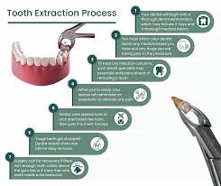 Image result for Tooth Extraction