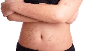 Tattoos mean different things to different people around the world. Treating Self Harm Or Self Injury Scars Burns And Tattoos With Lasers