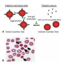 Image result for Indirect Coombs