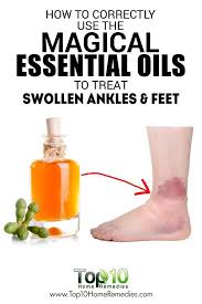 Pin On Essential Oil
