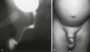 Image result for Umbilicus botryoides