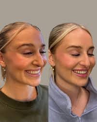 Rachel Codd DNP, AGACNP-BC (@rachelcodd.dnp) • Instagram photos and videos