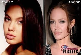 Angelina Jolie S Alleged Rhinoplasty Nose Job I Don T Think She S Had Any Work Done My Nose Was Angelina Jolie Nose Job Angelina Jolie Nose Plastic Surgery