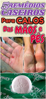 Calo Seco No Dedo Do Pé Esse Problema De Saude Pode Ser Facilmente Tratado E Curado Com Esses 5 Remedios Caseiros Muito Simples Conheca Eles Dicas Truques Receitas Caseiro Food