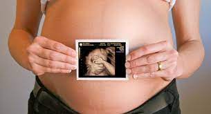 3d Ultrasound And 4d Ultrasound During Pregnancy Babycenter