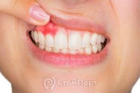 Maybe you would like to learn more about one of these? Opuhla Desna Chto Delat