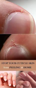 How To Stop Your Cuticle Skin From Peeling Peeling Nails Peeling Cuticles Healthy Nails