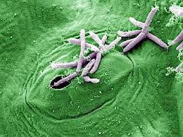 Image result for Pseudomonas syringae