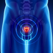 Dazu sollte allerdings nicht allein die digital rektale untersuchung der prostata genutzt werden. Prostata Krebs Ab 40 Muss Die Prostata Zum Check