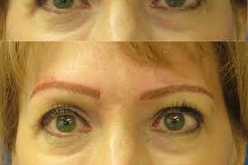 The center for aesthetics is the premier aesthetic medicine clinic in scottsdale, jackson hole, idaho falls. The Center For Plastic Surgery And Copper Aesthetics Beauty Health Traverse City Mi Weddingwire