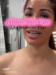 Navigating Treatment with Humor: The Lighter Side of Physical Therapy