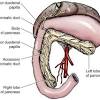 Pancreatic adenocarcinoma in cats neoplasm, or tumor, can be either benign or malignant in nature. 1